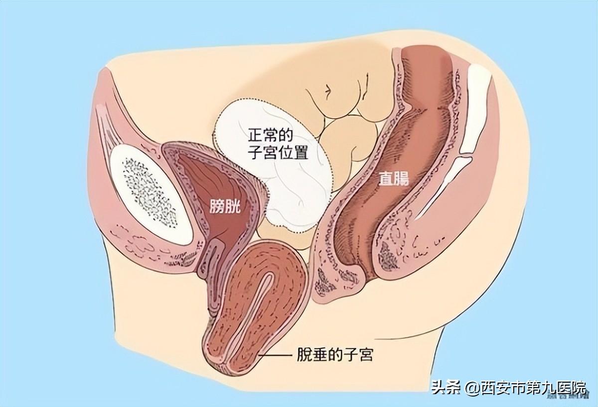 睪丸下垂松弛的原因及治療方法，睪丸下垂松弛的原因與治療方法解析