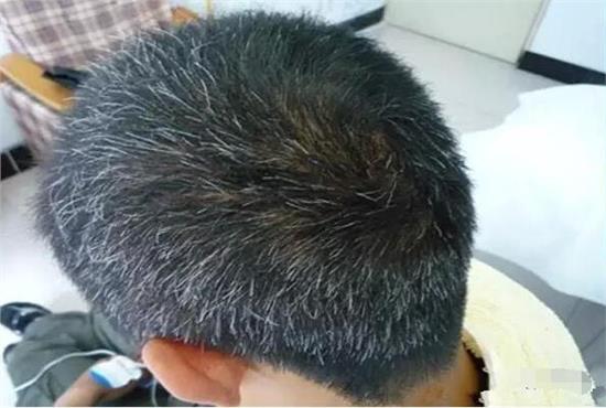 白發(fā)變黑發(fā)最好的土方法——自然黑發(fā)秘訣，自然黑發(fā)秘訣，白發(fā)變黑的土方法