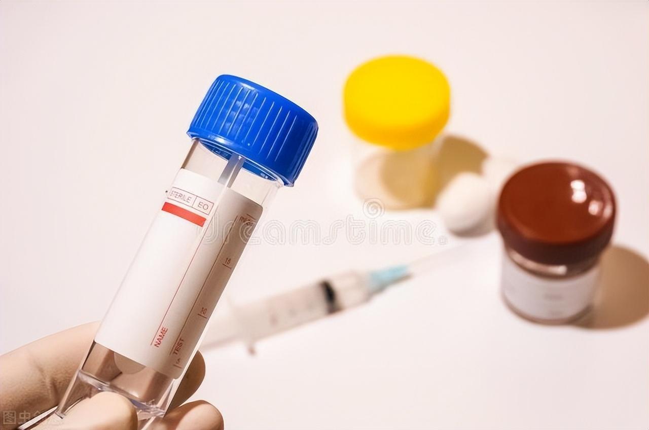 如何判斷是否得了痔瘡，痔瘡的判斷方法詳解