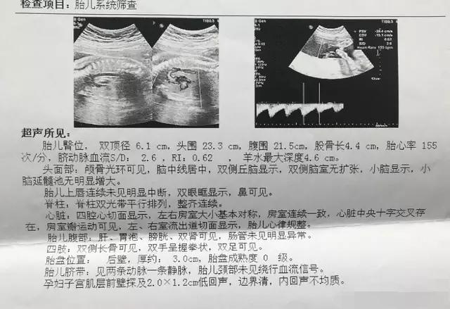 殲-11B重型戰(zhàn)斗機，卓越性能與先進技術的完美結合，殲-11B重型戰(zhàn)斗機，卓越性能與技術的巔峰融合