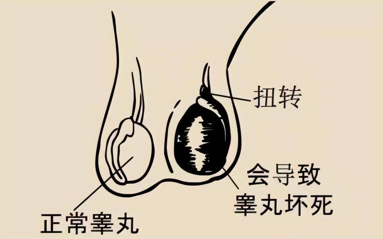 飛機(jī)打多了睪丸變小能恢復(fù)嗎？——探究原因與恢復(fù)可能性，飛機(jī)打多了睪丸變小能否恢復(fù)，原因與恢復(fù)可能性探討