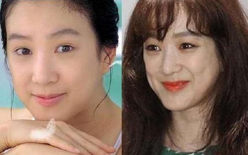 揭秘，韓國整容失敗的十大明星，揭秘，韓國整容失敗的明星TOP 10名單曝光