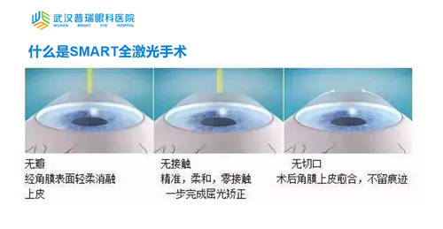 晶體植入近視手術(shù)的利與弊，全面解析與深度探討，晶體植入近視手術(shù)的利與弊，全面解析與深度探討深度探討及解析近視手術(shù)晶體植入利弊