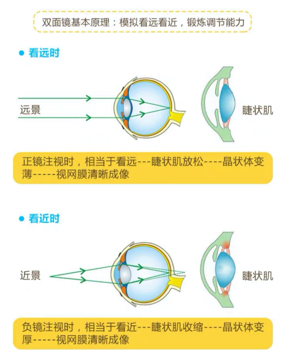 糾正眼睛近視的有效辦法，糾正眼睛近視的有效方法總結(jié)