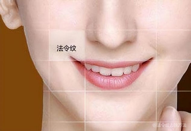 如何去除法令紋——打造青春無痕肌膚，如何消除法令紋，重塑青春無瑕肌膚